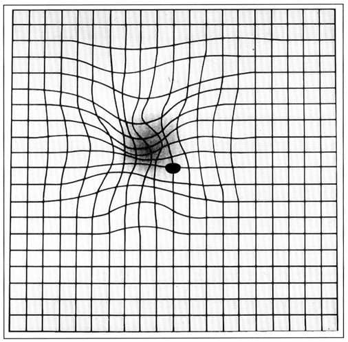 An illustration of straight lines appearing distorted when central vision is affected. This illustrates a symptom and is not a diagnostic self test.