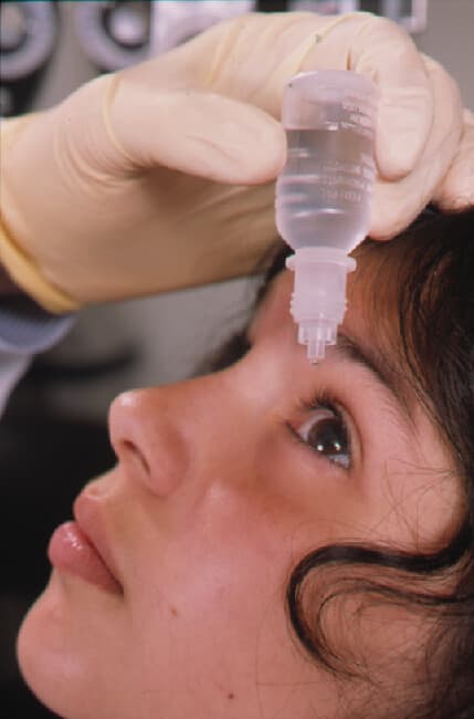 Instilling a drop into the eye. Lubricating drops are one option for dry eye according to the treating team’s advice. Keep the bottle tip away from the eye and eyelashes.