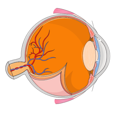 An illustration of eye anatomy. The uvea includes the iris, ciliary body and choroid, and inflammation can affect different parts.